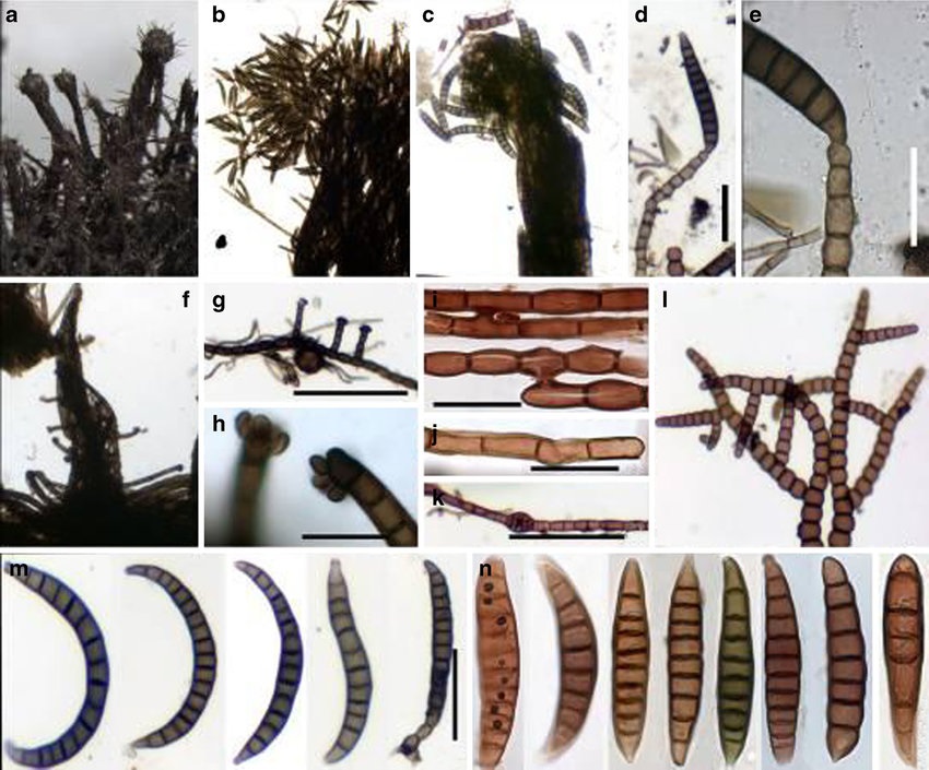 Представитель Семейства Euantennariaceae